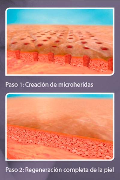 proceso de regeneración de la piel